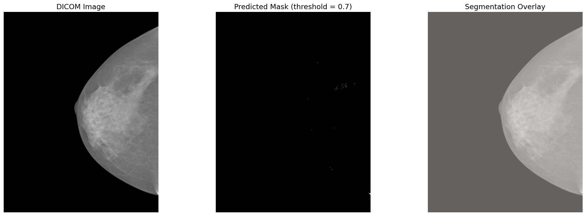 Deep segmentation inference: DICOM image, predicted mask, and overlay